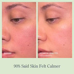 Before and after photos showing 90% of users felt calmer skin after use
