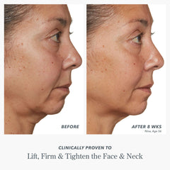 Before and after photos showing lifted firmer skin after 8 weeks of Milk RX