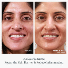 Before and after photos showing repaired skin barrier and reduced inflammaging