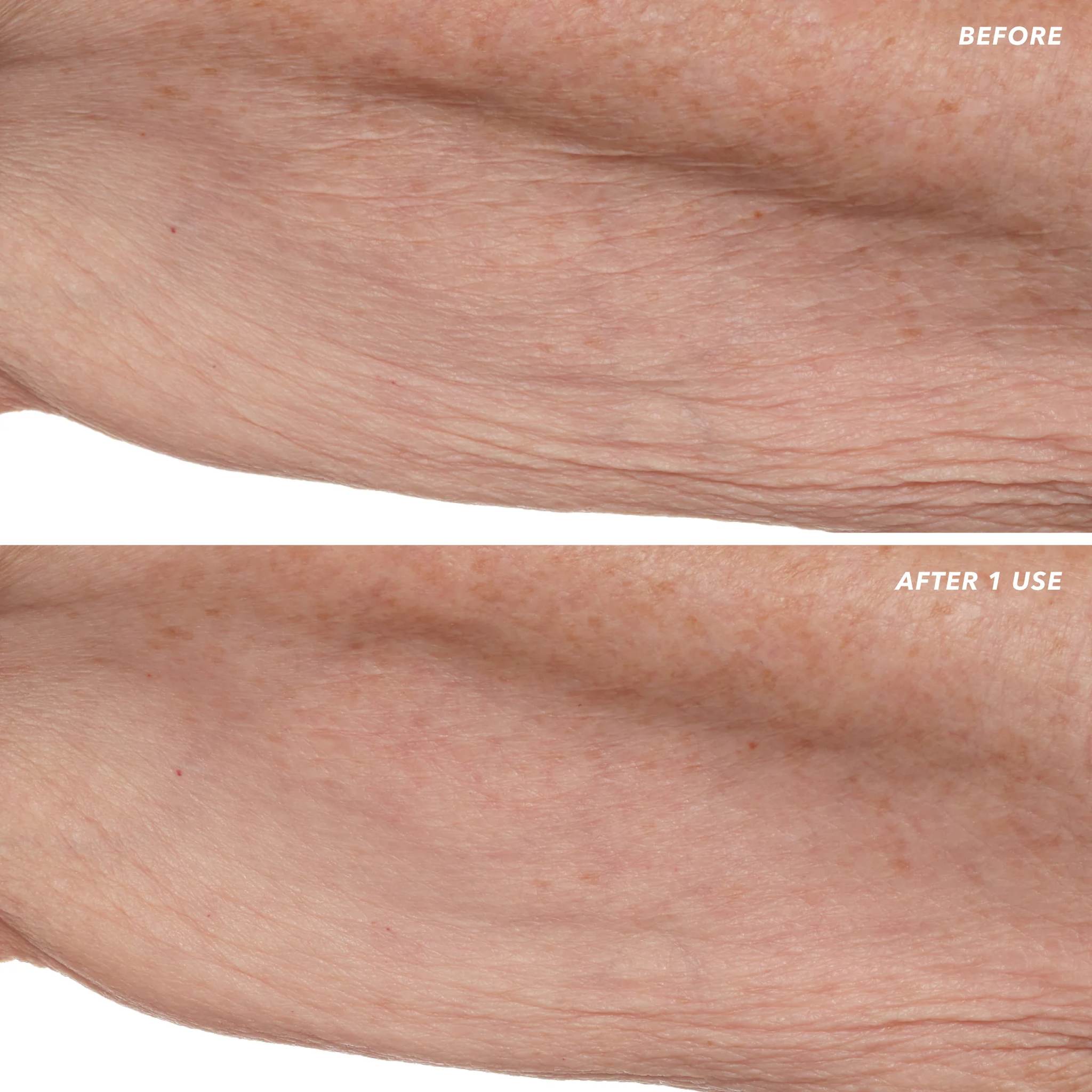Before and after arm photos showing instantly smoothed crepey skin after one use