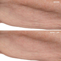 Before and after arm photos showing instantly smoothed crepey skin after one use