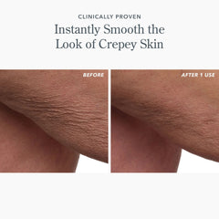 Before and after arm closeup showing smoother skin texture after one use