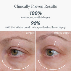 Clinically proven results showing 100 percent saw more youthful looking eyes