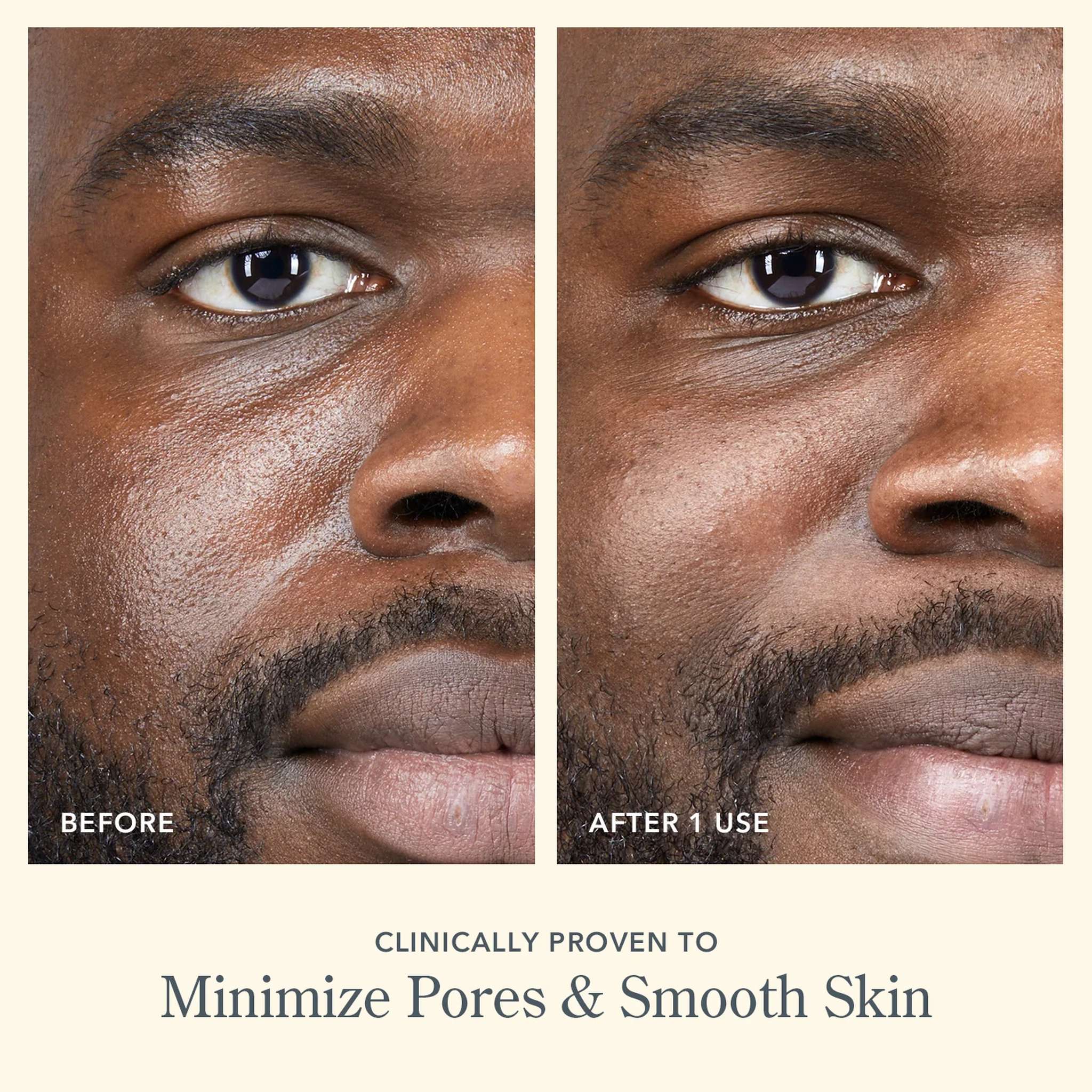 Before and after photos showing minimized pores and smoother skin after one use