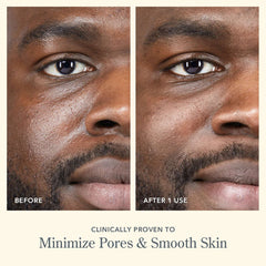 Before and after photos showing minimized pores and smoother skin after one use