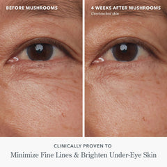 Before and after eye photos showing re-awakened tired eyes after 4 weeks