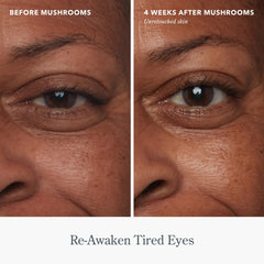 Before and after under eye photos showing minimized fine lines after 4 weeks