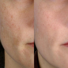 PMD Personal Microderm Classic Berry 4