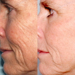 PMD Personal Microderm Classic Berry 5