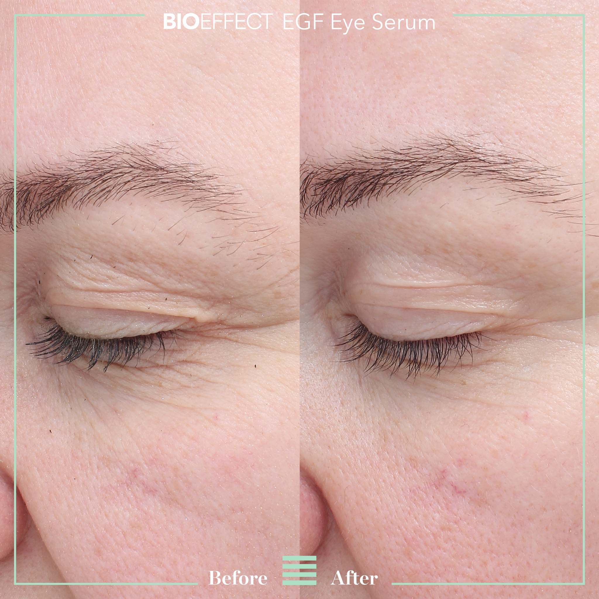 BioEffect EGF Eye Serum before and after showing visibly reduced crow's feet and fine lines around eye