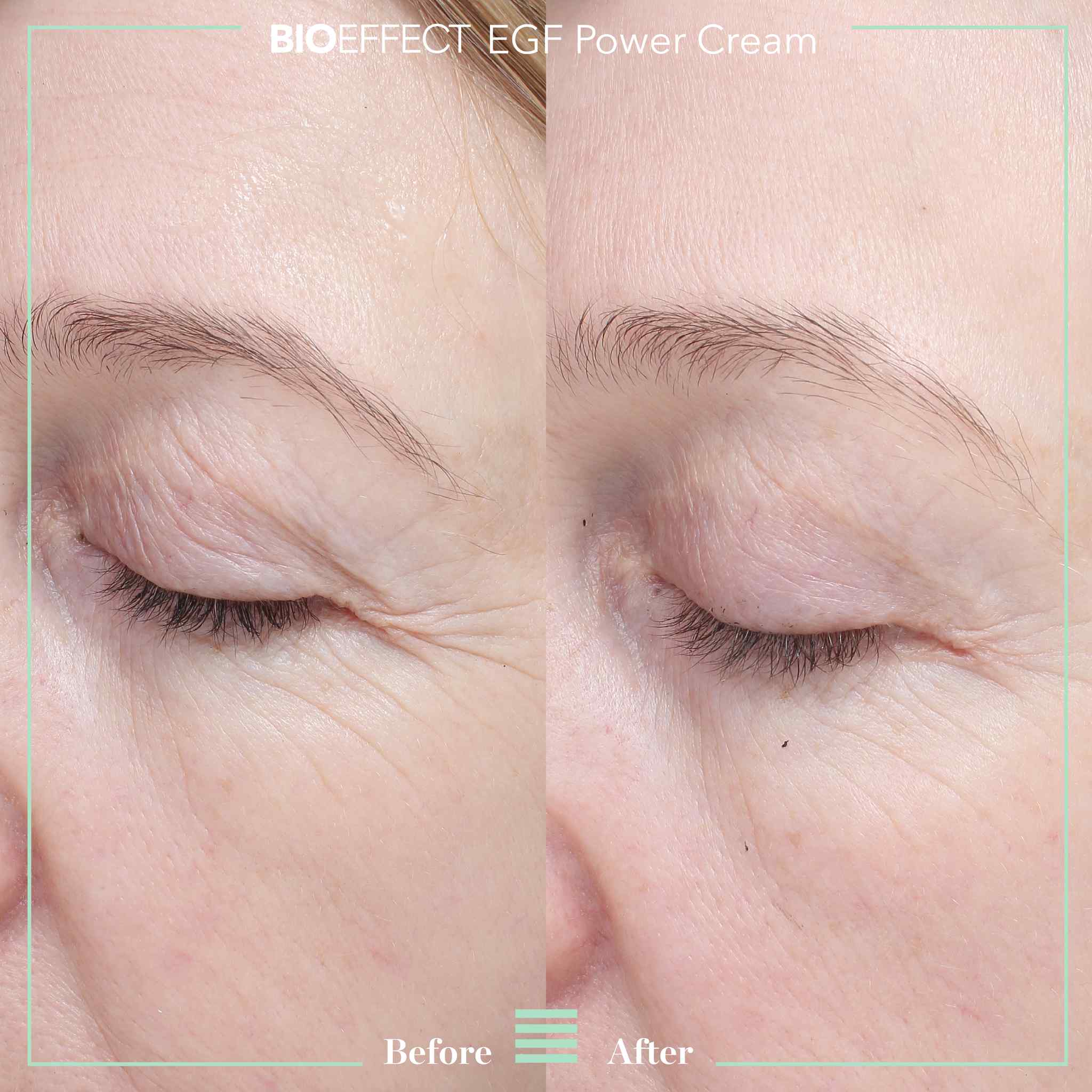 Before and after close-up showing visibly reduced eye area wrinkles and crow's feet after using BIOEFFECT EGF Power Cream