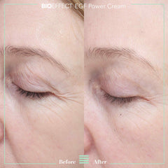 Before and after close-up showing visibly reduced eye area wrinkles and crow's feet after using BIOEFFECT EGF Power Cream
