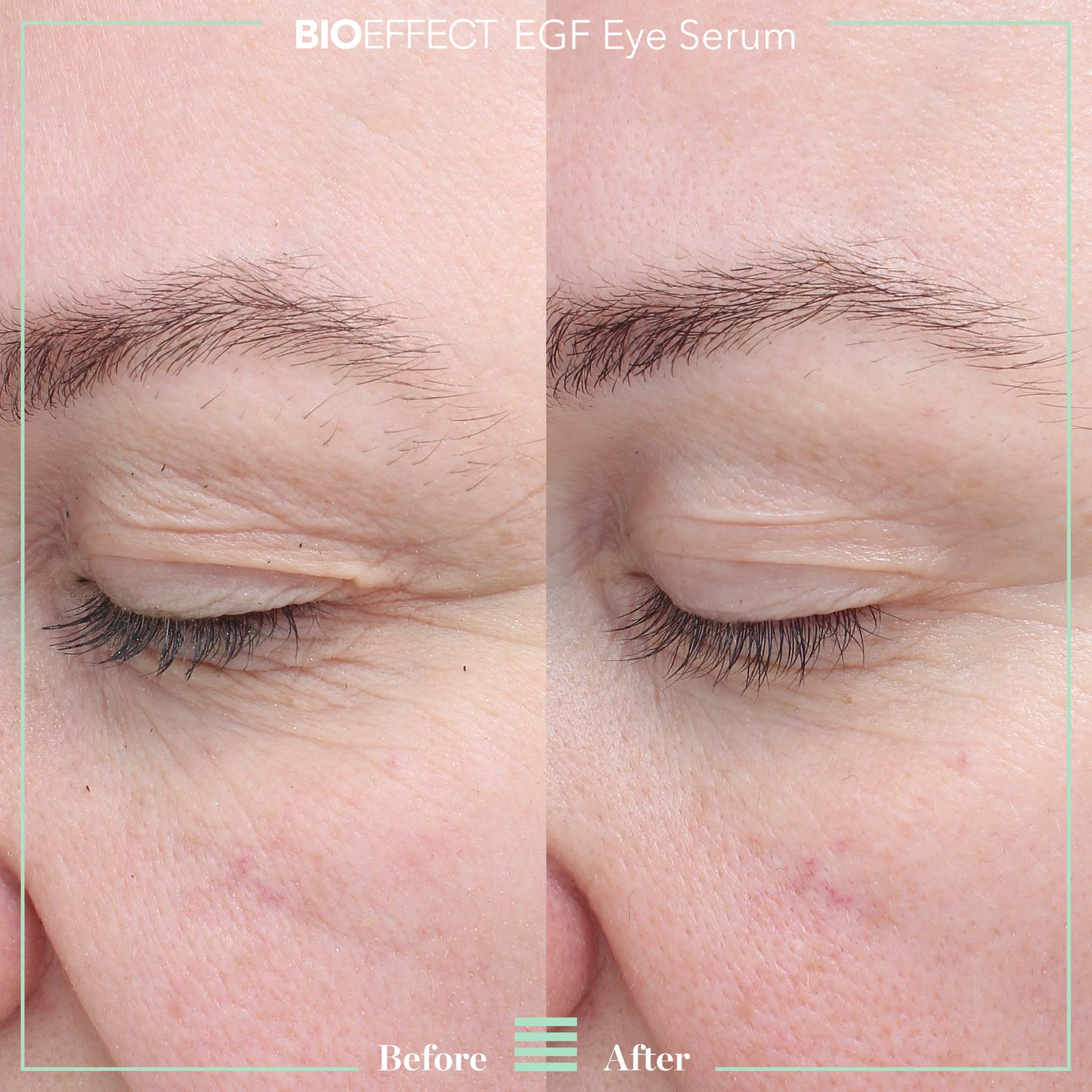 BioEffect EGF Power Eye Cream before and after showing visibly smoother skin and reduced crow's feet