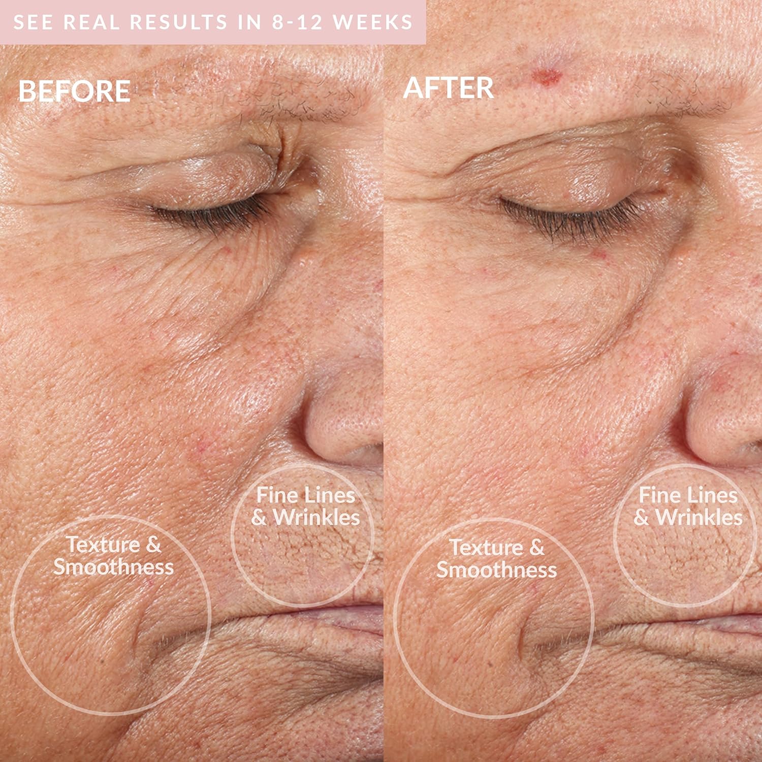 PMD Microderm Classic Blush 4