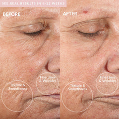 PMD Microderm Classic Blush 4