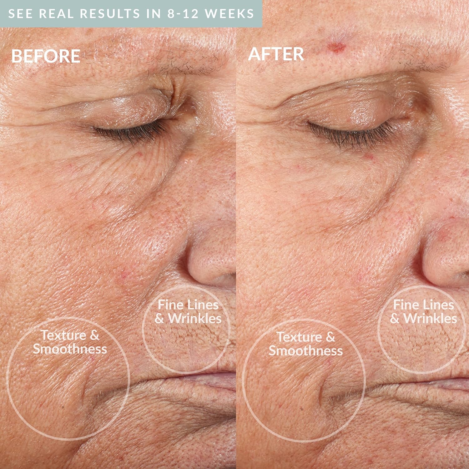 PMD Microderm Classic Grey 4