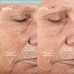 PMD Microderm Classic Grey 4