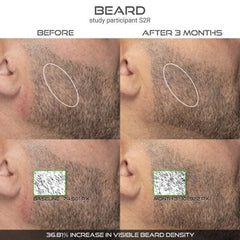 Defenage 150K Hair Follicle Serum for Scalp & Beard - Men's Edition