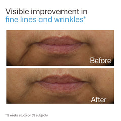 Before and after close-up showing visible improvement in fine lines and wrinkles with EltaMD UV Daily Hydration+