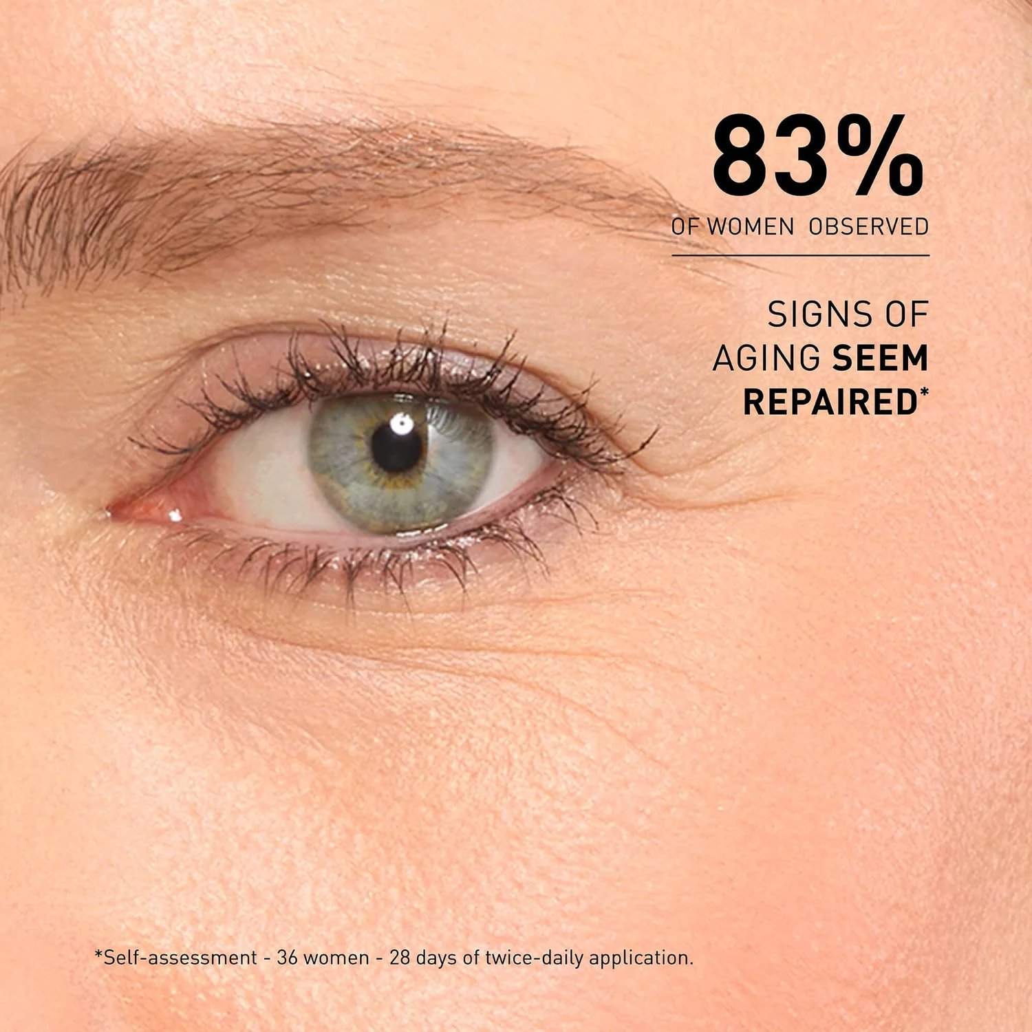 Close-up eye area showing improved skin after using Filorga Global-Repair Advanced Elixir