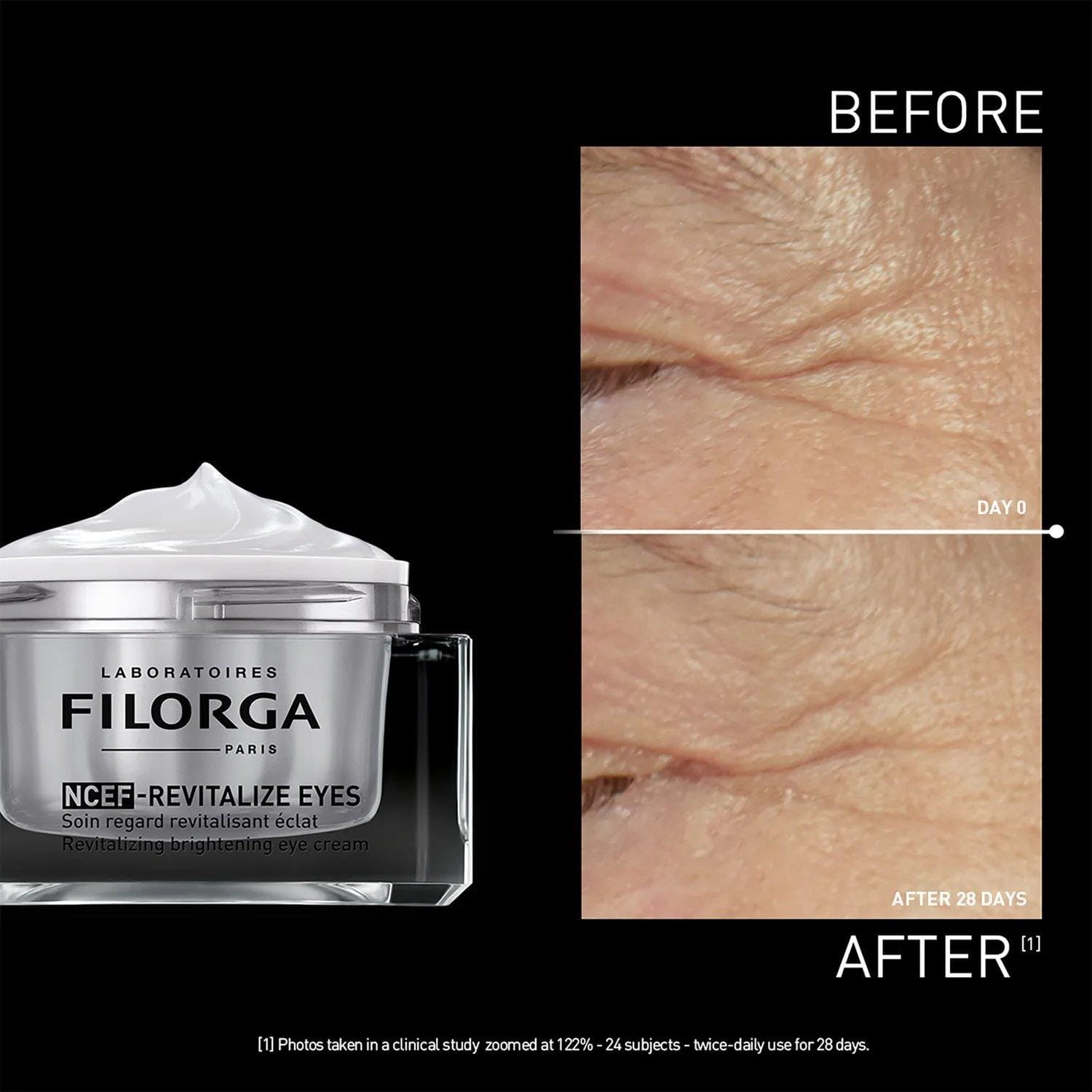 Filorga NCEF-Revitalize Eyes before and after 28 days showing reduced crow's feet wrinkles around the eye area