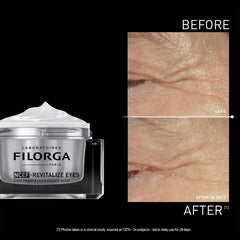 Filorga NCEF-Revitalize Eyes before and after 28 days showing reduced crow's feet wrinkles around the eye area