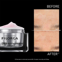 Filorga NCEF-Revitalize Night before and after 28 days showing improved skin texture and reduced fatigue signs
