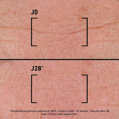 Filorga Time-Filler Intensive 5XP before and after J0 versus J28 skin close-up showing reduced wrinkles after 28 days