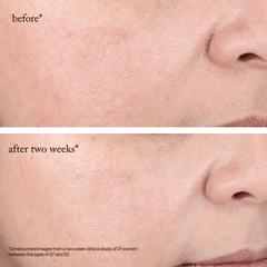 goop Beauty 15% Glycolic Acid Overnight Glow Peel exfoliating treatment pads with 15% glycolic acid to smooth texture and brighten skin overnight. Available at Exclusive Beauty Club.