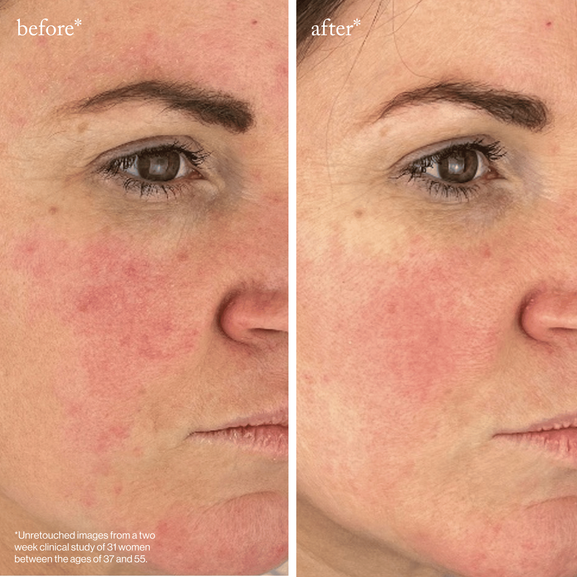 goop Beauty Youth-Boost Peptide Serum anti-aging peptide face serum with niacinamide and ceramides to firm and smooth skin. Available at Exclusive Beauty Club.