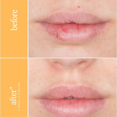 Lips before and after two weeks of daily GrandePOUT Plumping Lip Mask use