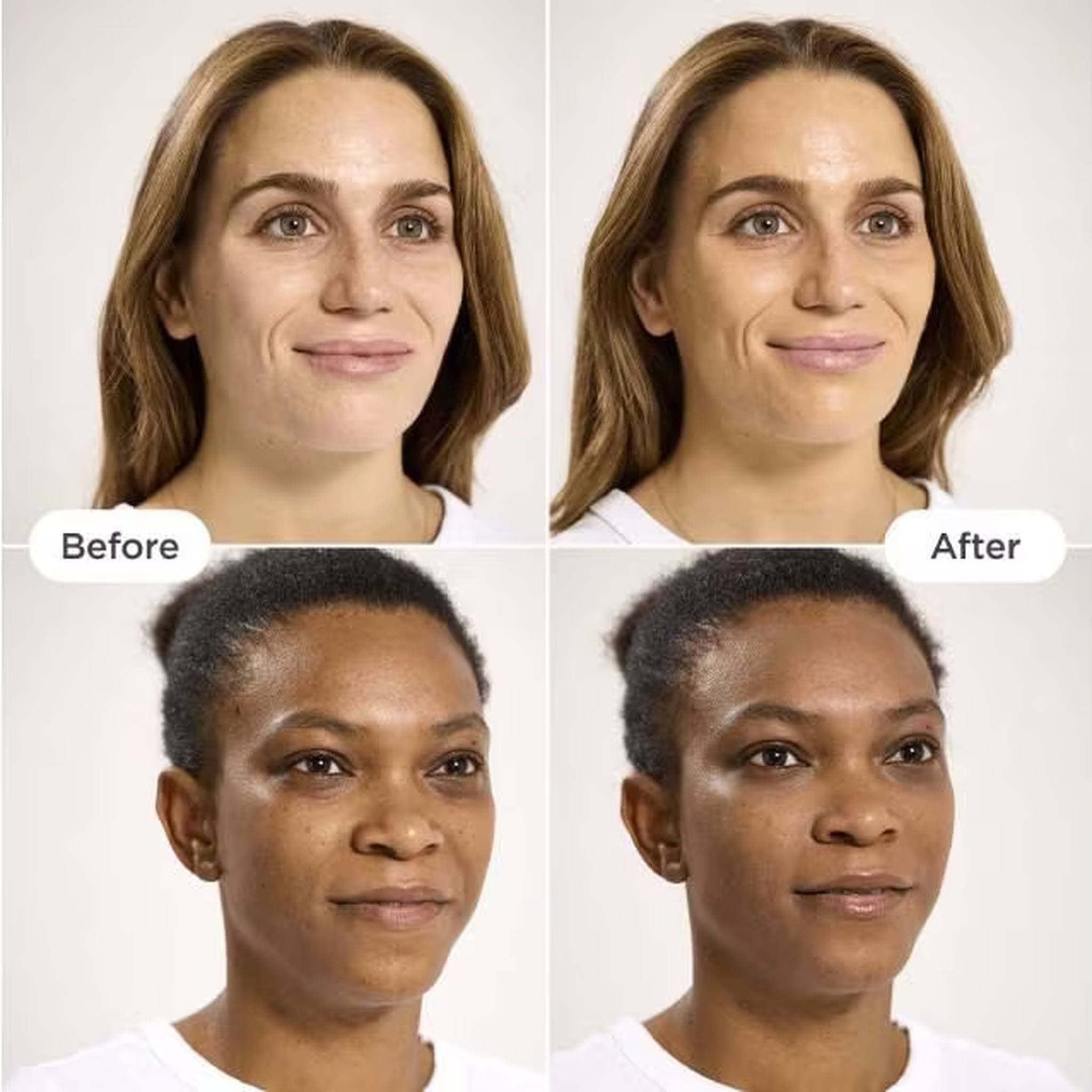 Before and after results using tinted mineral sunscreen for skin tone