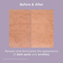 ISDIN Isdinceuticals Glicoisdin 25 Intense