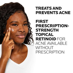 Woman applying Effaclar Adapalene Gel prescription strength acne treatment
