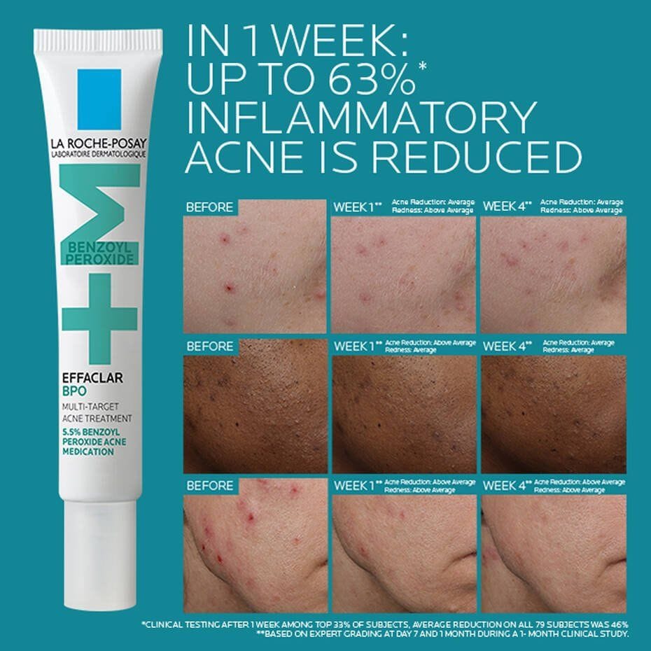 La Roche-Posay Effaclar BPO before and after results showing up to 63% inflammatory acne reduction in 1 week