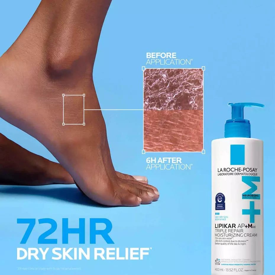 Foot skin before and after 6 hours of Lipikar AP+M dry skin relief