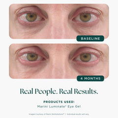 Marini Skin Solutions Luminate Eye Gel