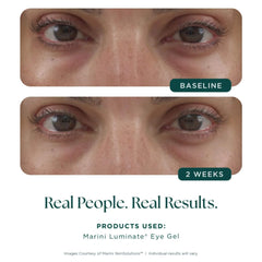 Marini Skin Solutions Luminate Eye Gel