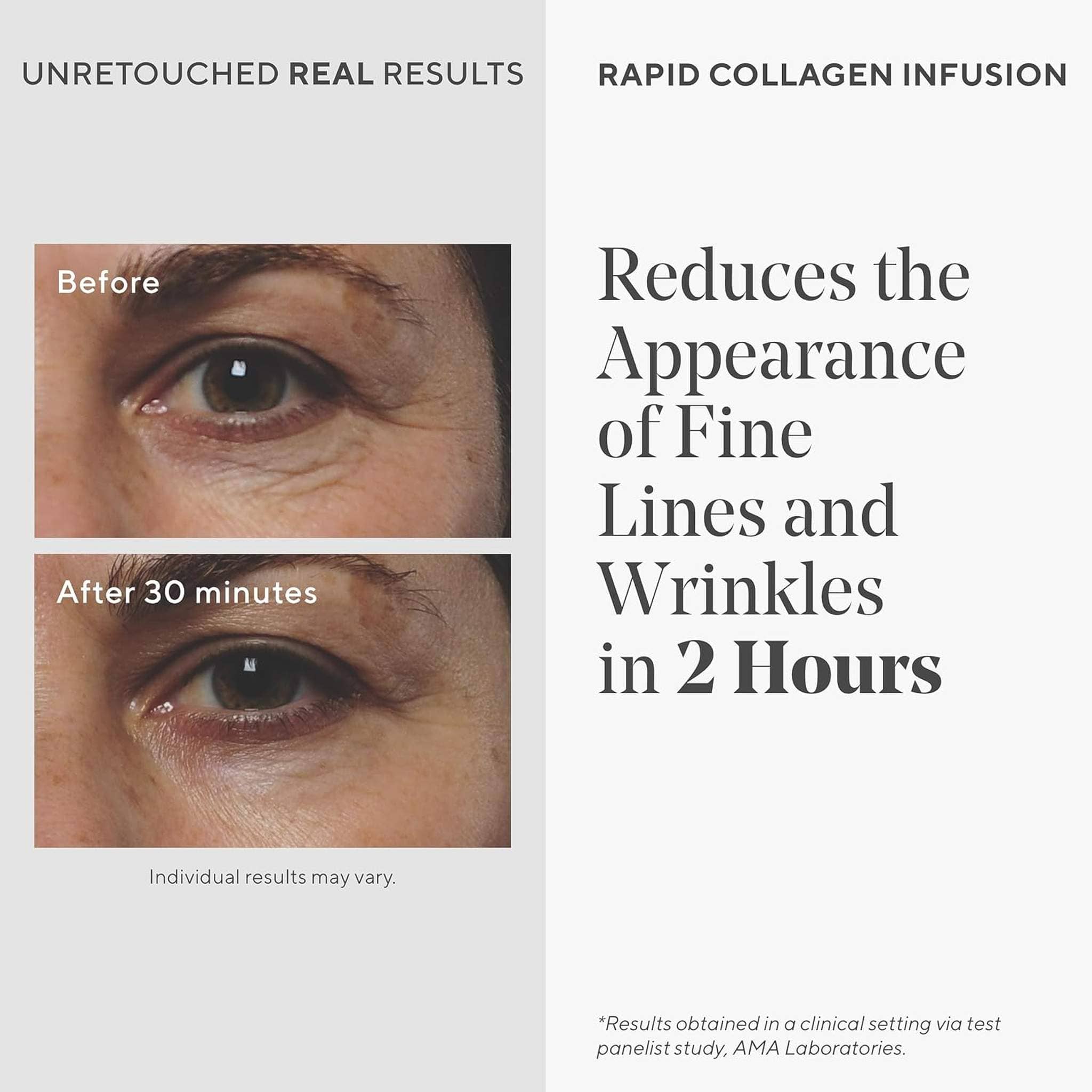 Before and after eye area results using Murad Rapid Collagen Infusion serum