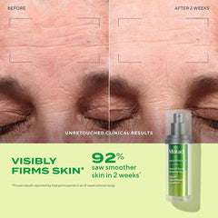 Unretouched before and after forehead wrinkle results in two weeks