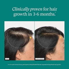 Nutrafol Women clinical study before and after hair growth results