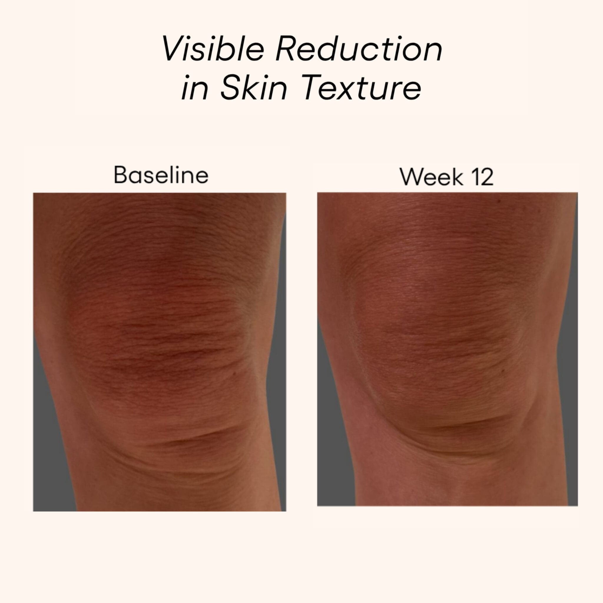 Plated Body Serum before and after results showing improved skin texture on knee area