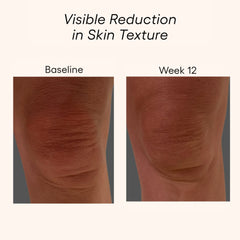 Plated Body Serum before and after results showing improved skin texture on knee area