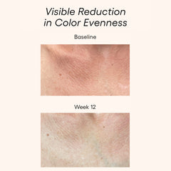 Plated Body Serum before and after results showing visible wrinkle reduction on chest skin