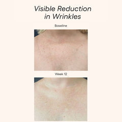 Plated Body Serum before and after results showing more even skin tone on chest skin