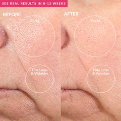 PMD Microderm Pro Pink 4