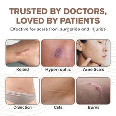 PROSIL Silicone Scar Stick SPF 15