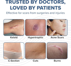 PROSIL Silicone Scar Stick