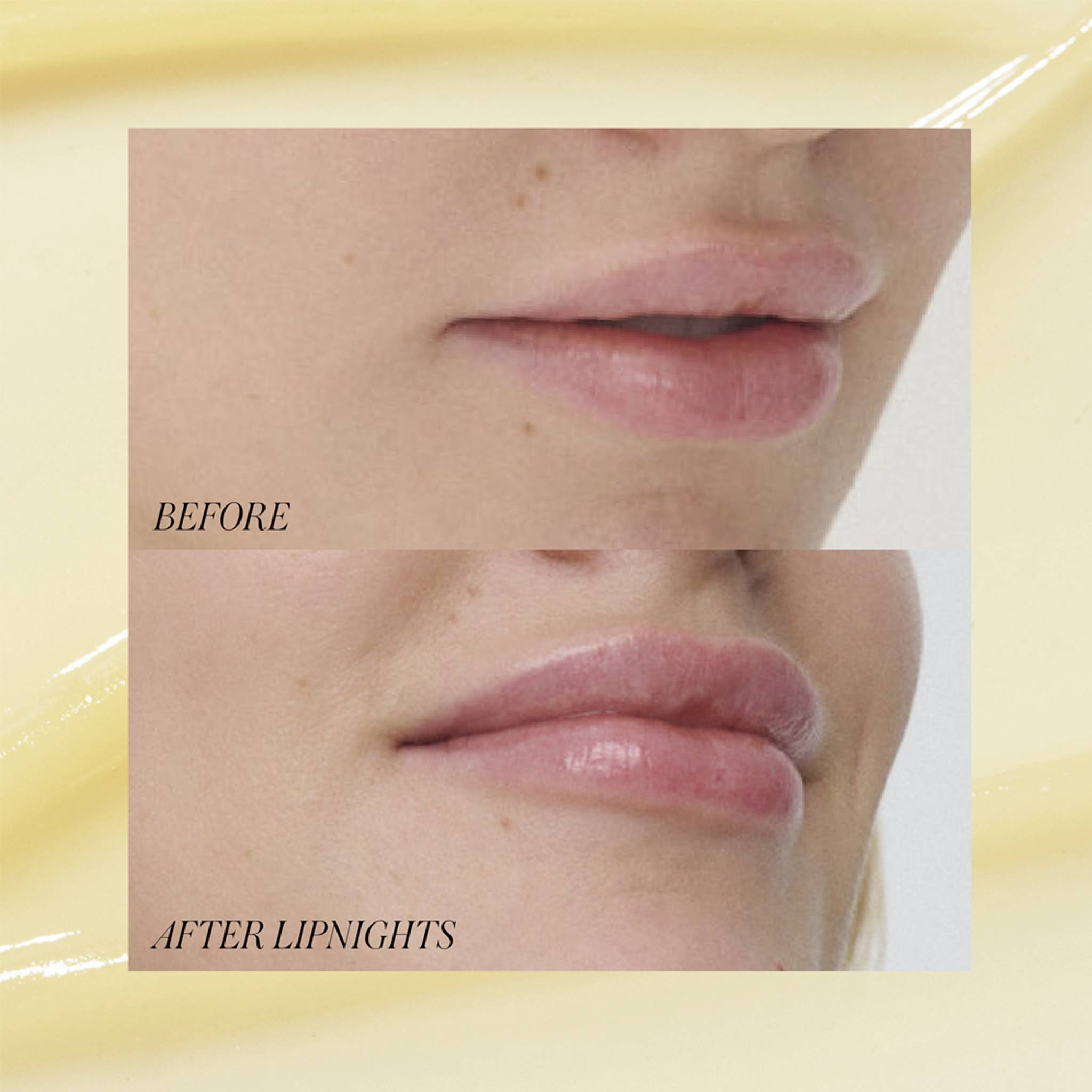 Before and after comparison of lips showing smoother texture with Lipnights