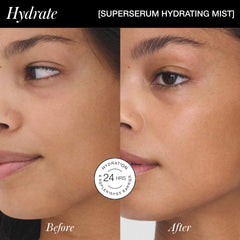 Bare skin compared to SuperSerum mist application showing hydration
